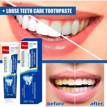 120 г Бързото Възстановяване на зъбния Кариес и Избелване на Зъбите Премахване на Паста за зъби Fresh Care Of Възстановяване на Петната От зъбния Кариес и плака в Устата Prod U6W3